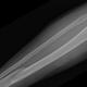 Some guy named Robert Earl’s broken leg (Image: rearl/Flickr)